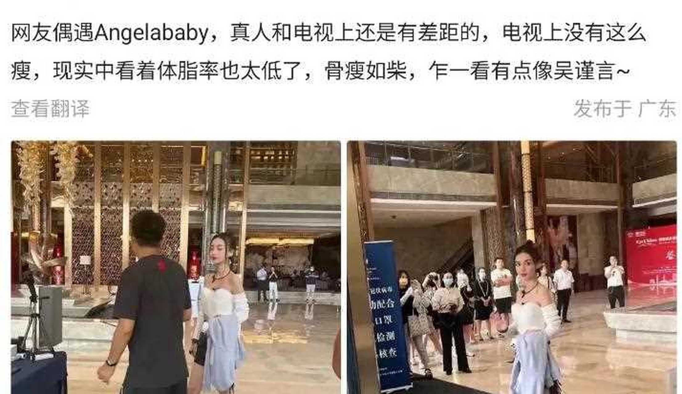 baby瘦得皮包骨图片