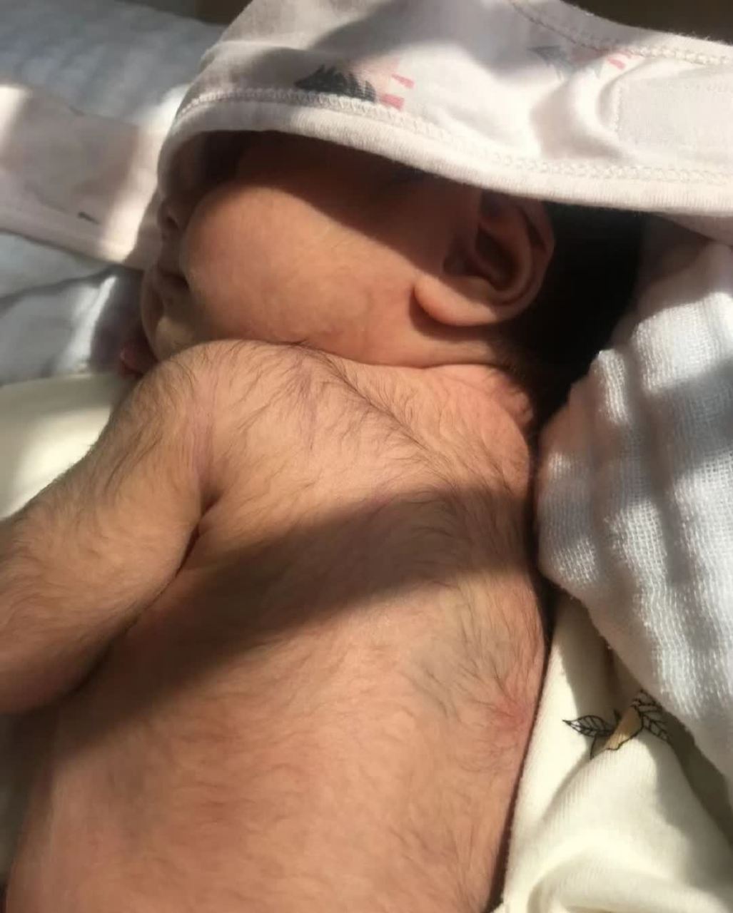 第一次当妈妈的我想问一下,刚出生的宝宝有那么多体毛吗?