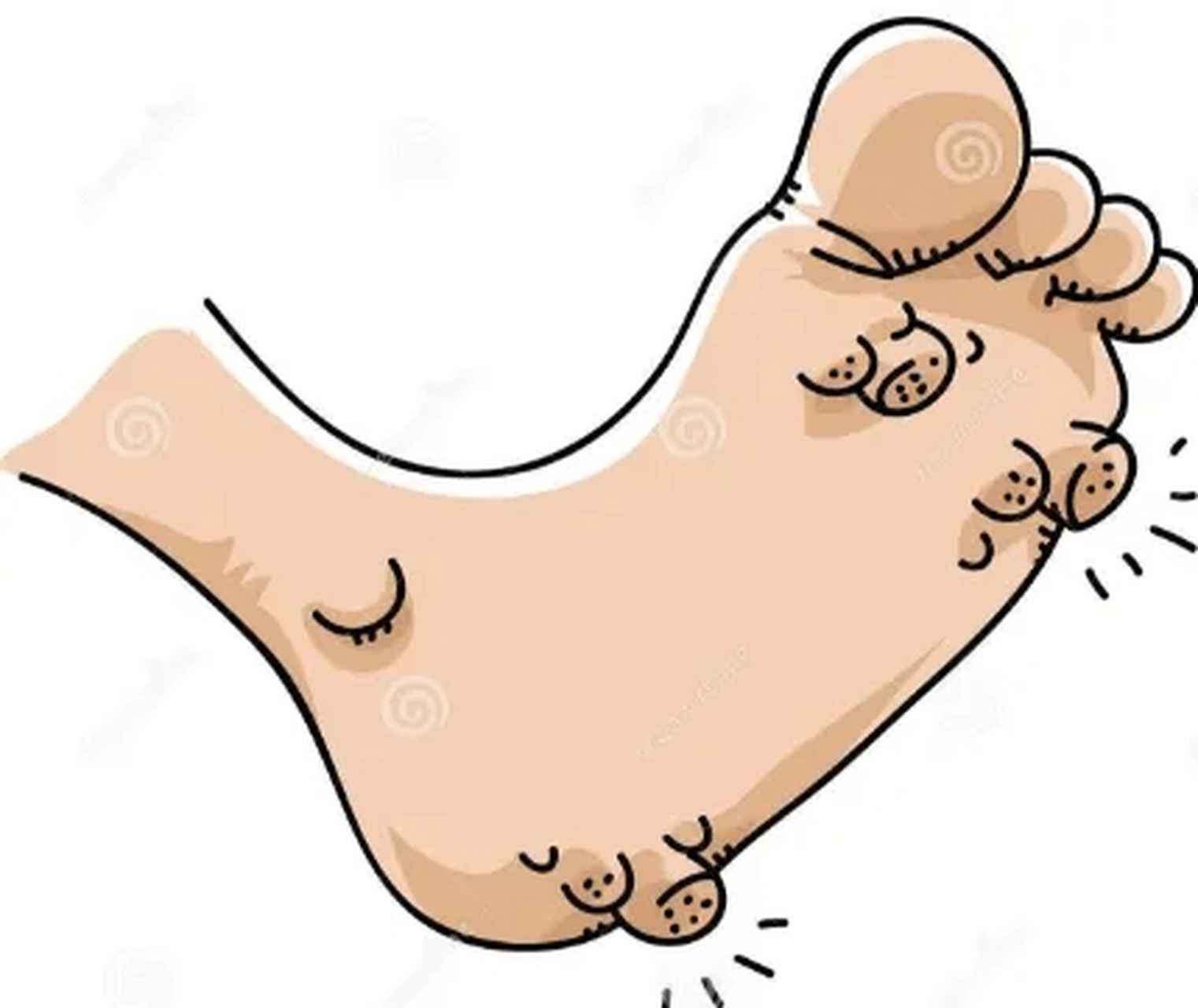 手上长疣是一种常见的皮肤问题,需要采取适当的治疗方法进行处理,在