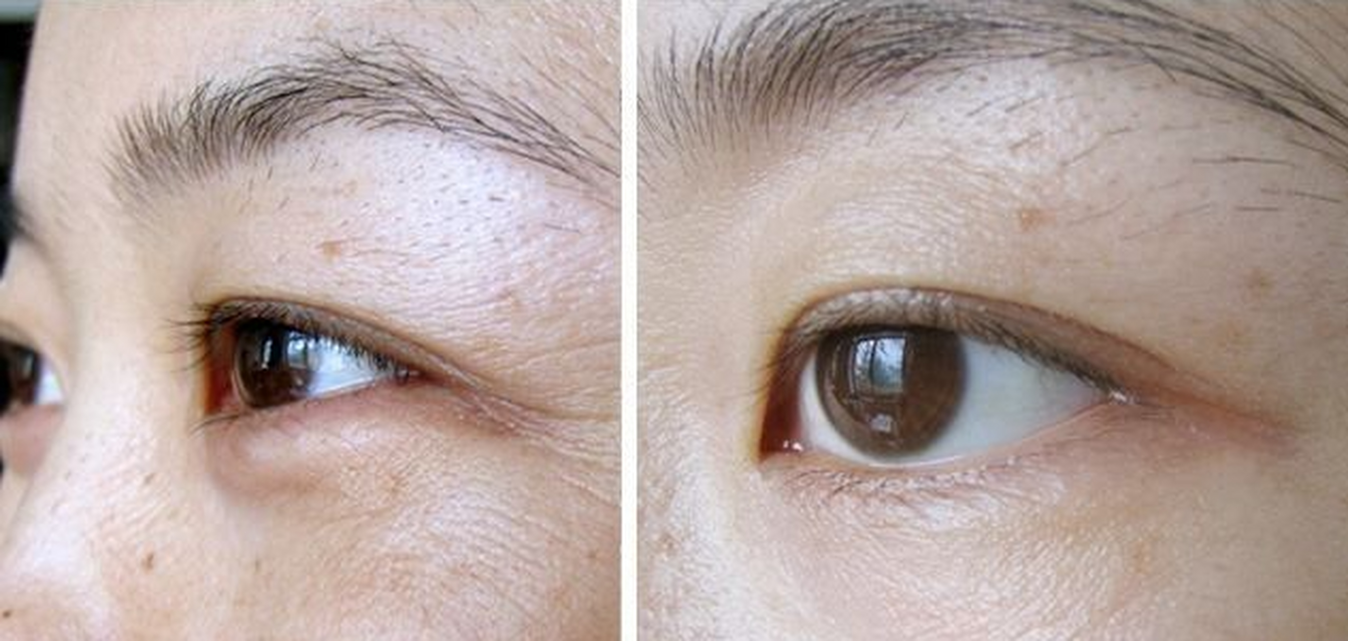 美容领域,而根据个人的皮肤类型和需要来选择合适的方法是非常重要的