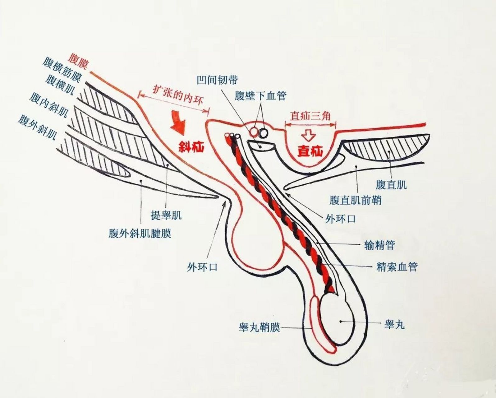 【老年男性腹股沟疝多发的原因】  由于男性在最早