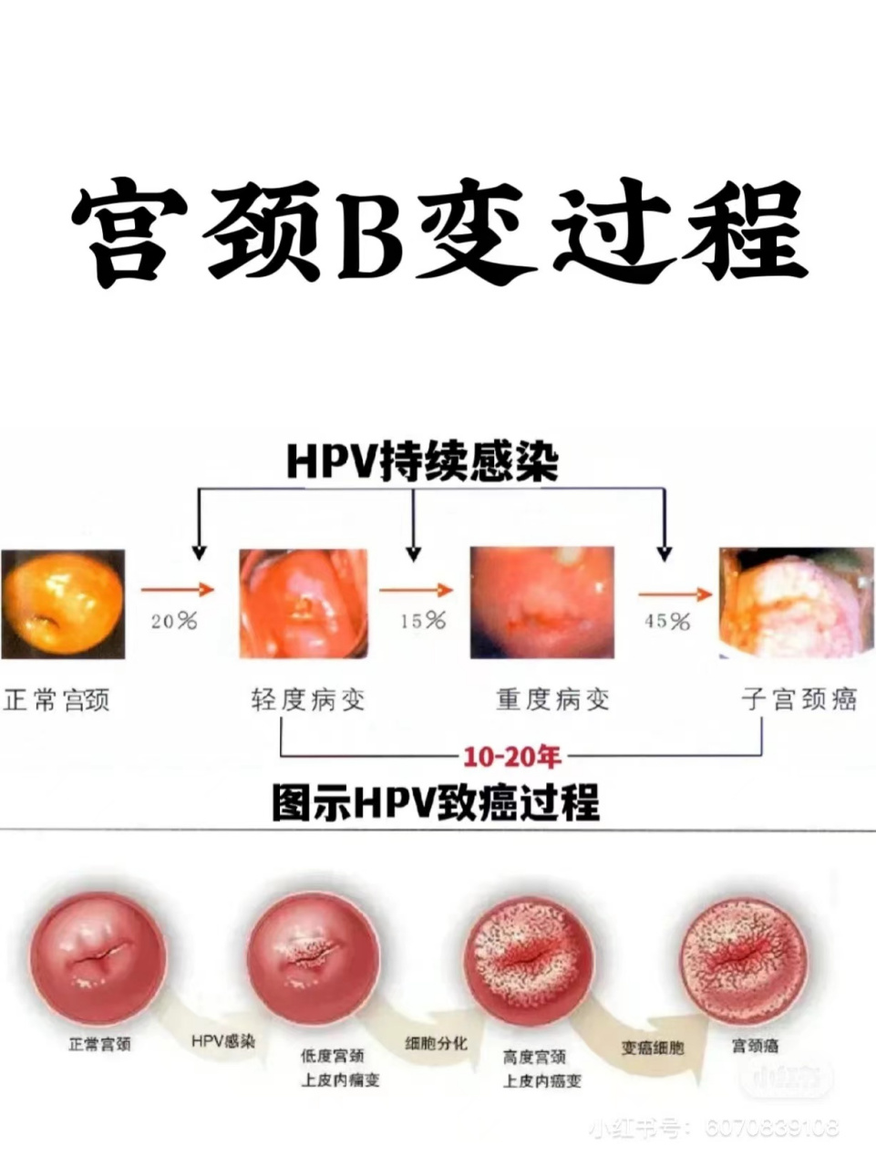 顺产后宫颈图片形状图片