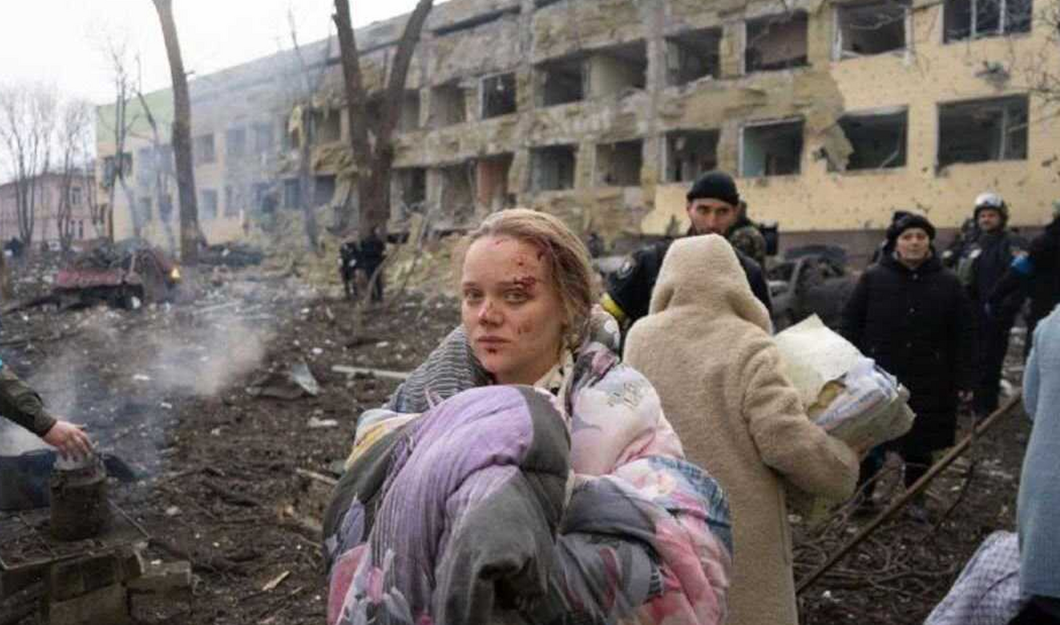 俄乌战争儿童惨烈图片图片