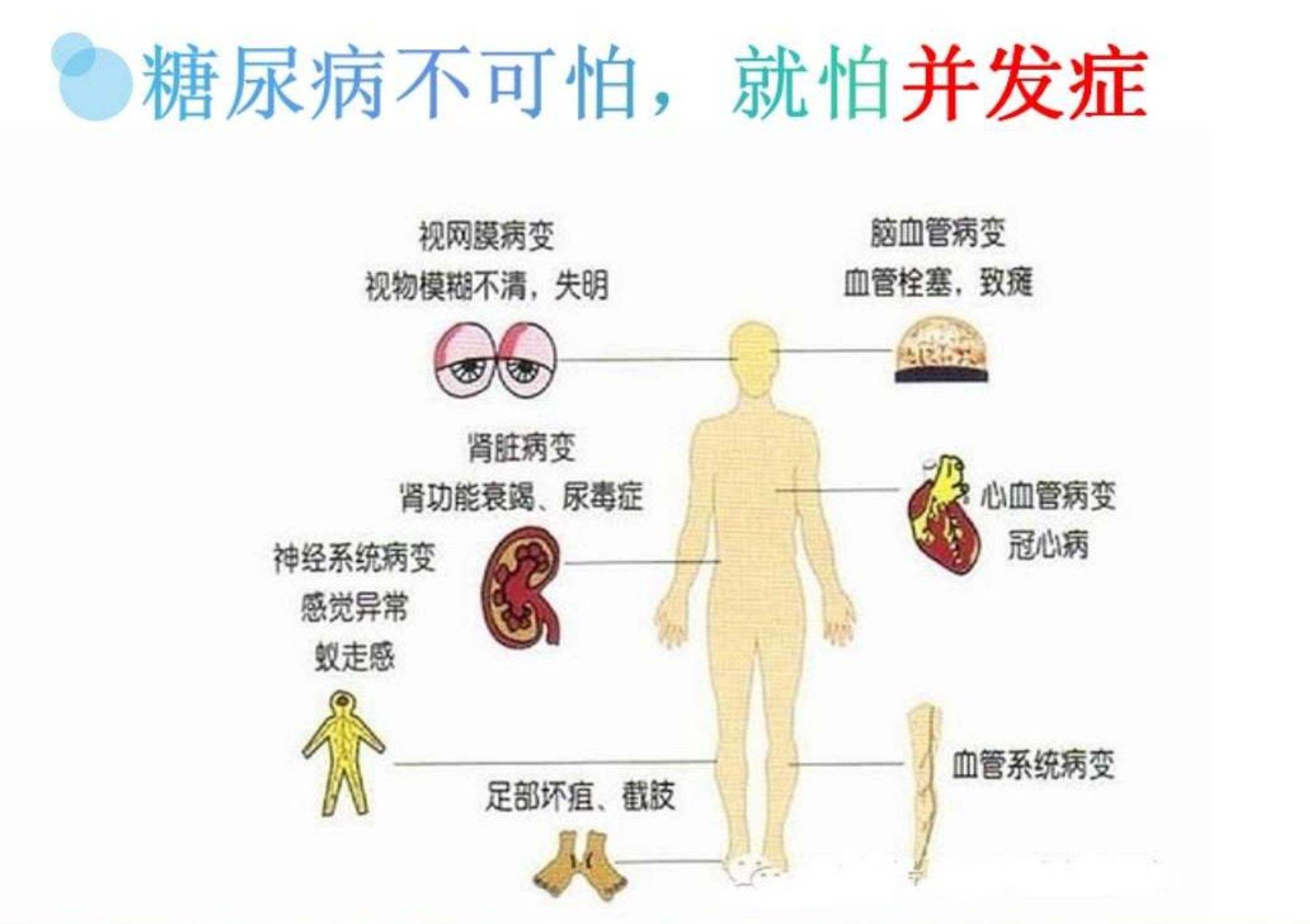 糖尿病并发症会导致图片