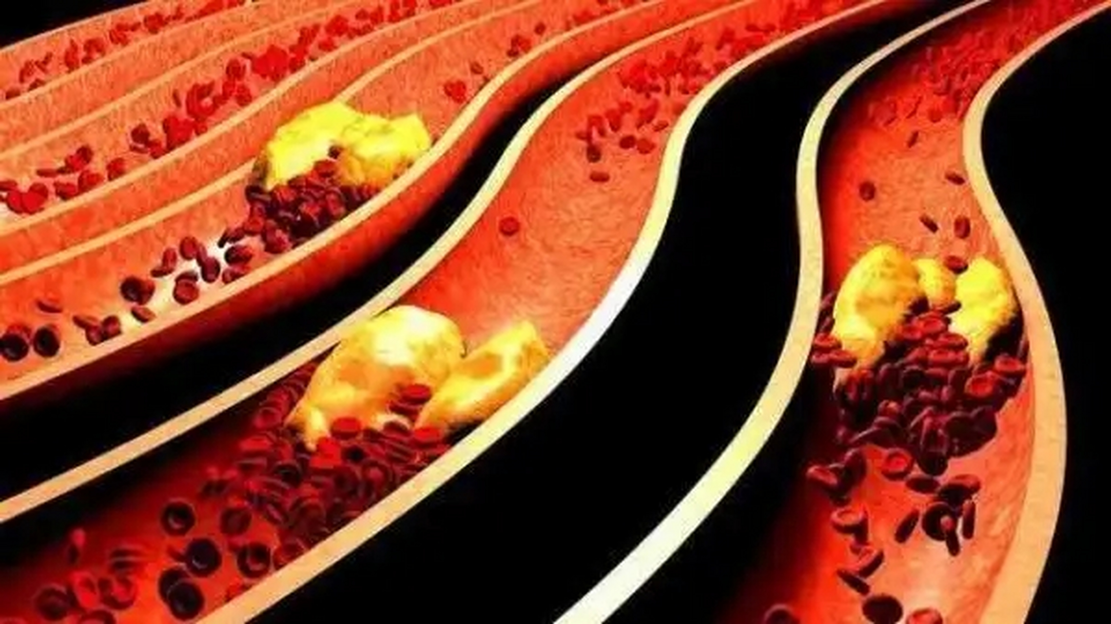 来听听!什么是甘油三酯?"医生在线"-第2张图片-瑞康博客