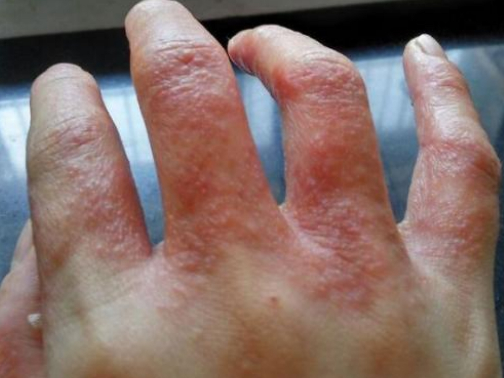 错,或是湿气过重发出的"暗示"  春天来了,气温回暖加上空气湿度加大