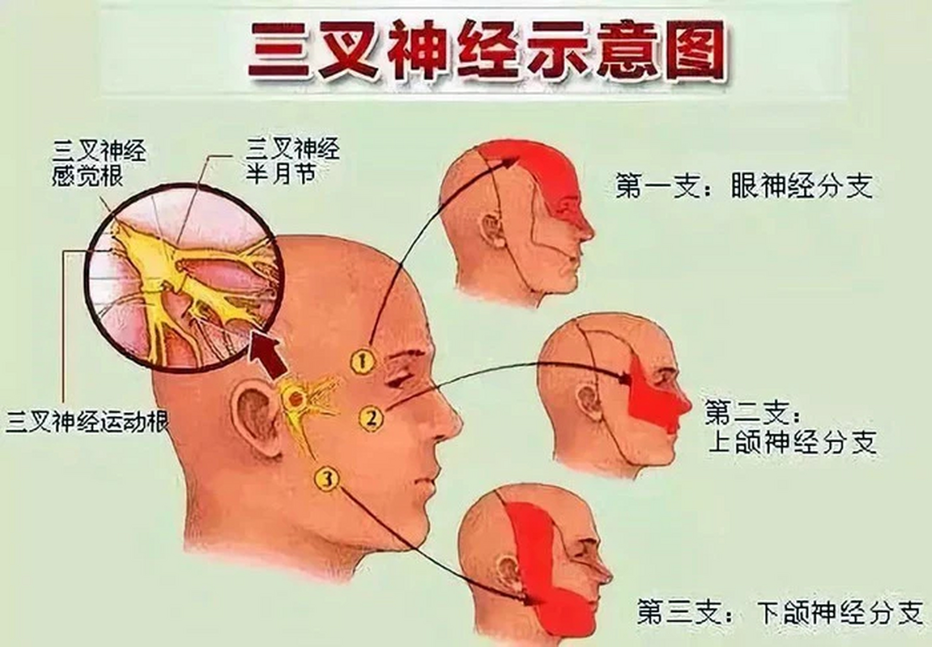 三叉神经疼在哪个部位图片