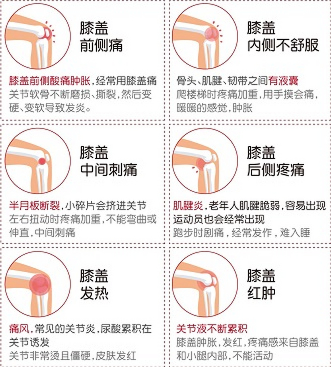 膝盖为什么会痛