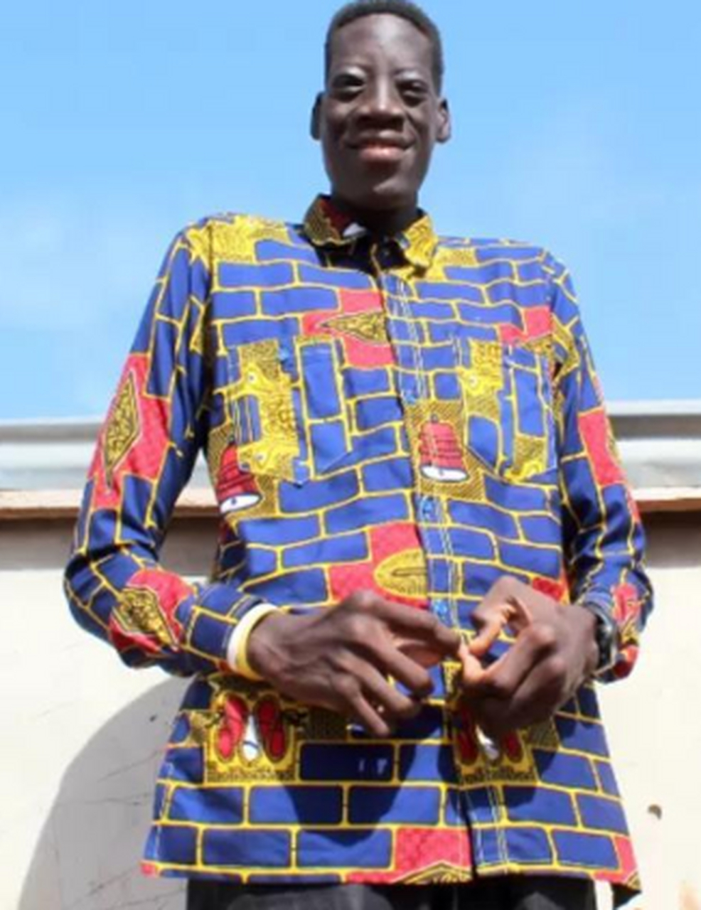 世界上最高的人身高2.89米,想结婚生子却不得不先治病.