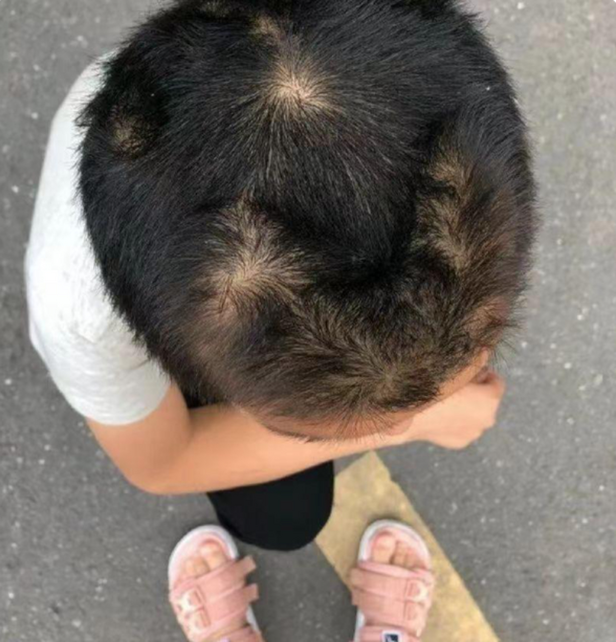 记得小时候的顺口溜是一个旋好,两个旋坏,这么多按小时候怎么说