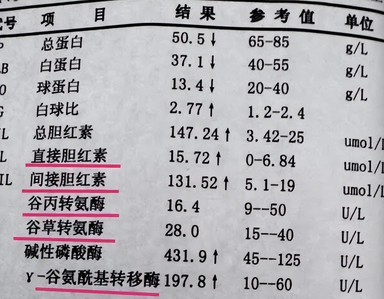 转氨酶为什么会高