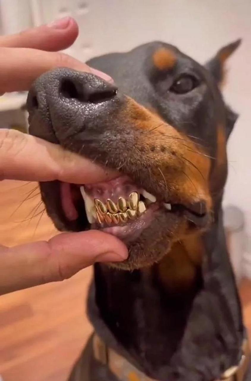 老掉牙了,今天去医院安装的大金牙!