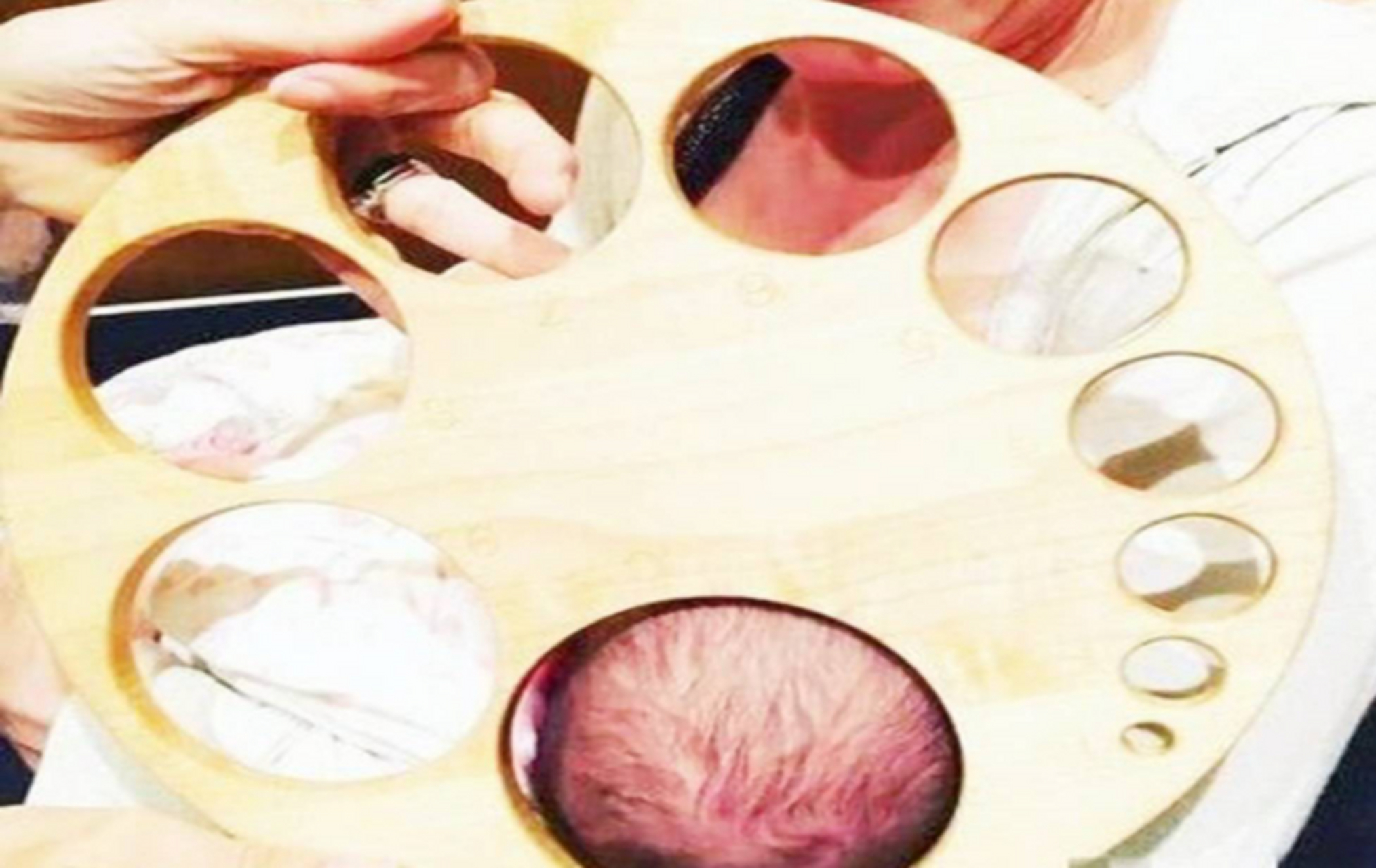 听说孕期宫口开大,羊膜囊凸出,是不是有点小紧张呢?