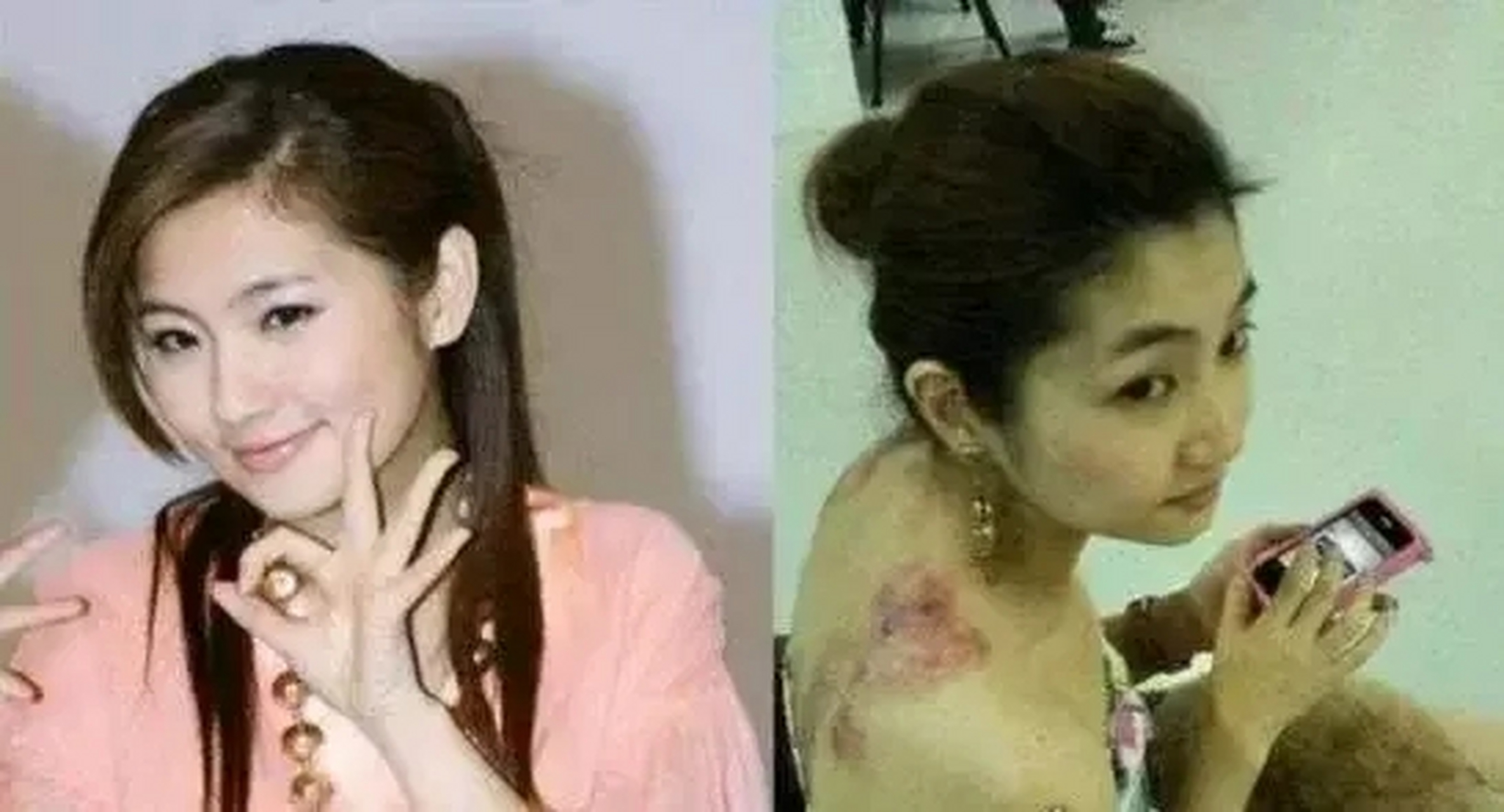 2010年,任家萱意外烧伤,未婚夫张承中没有抛弃她,两个人举行了婚礼