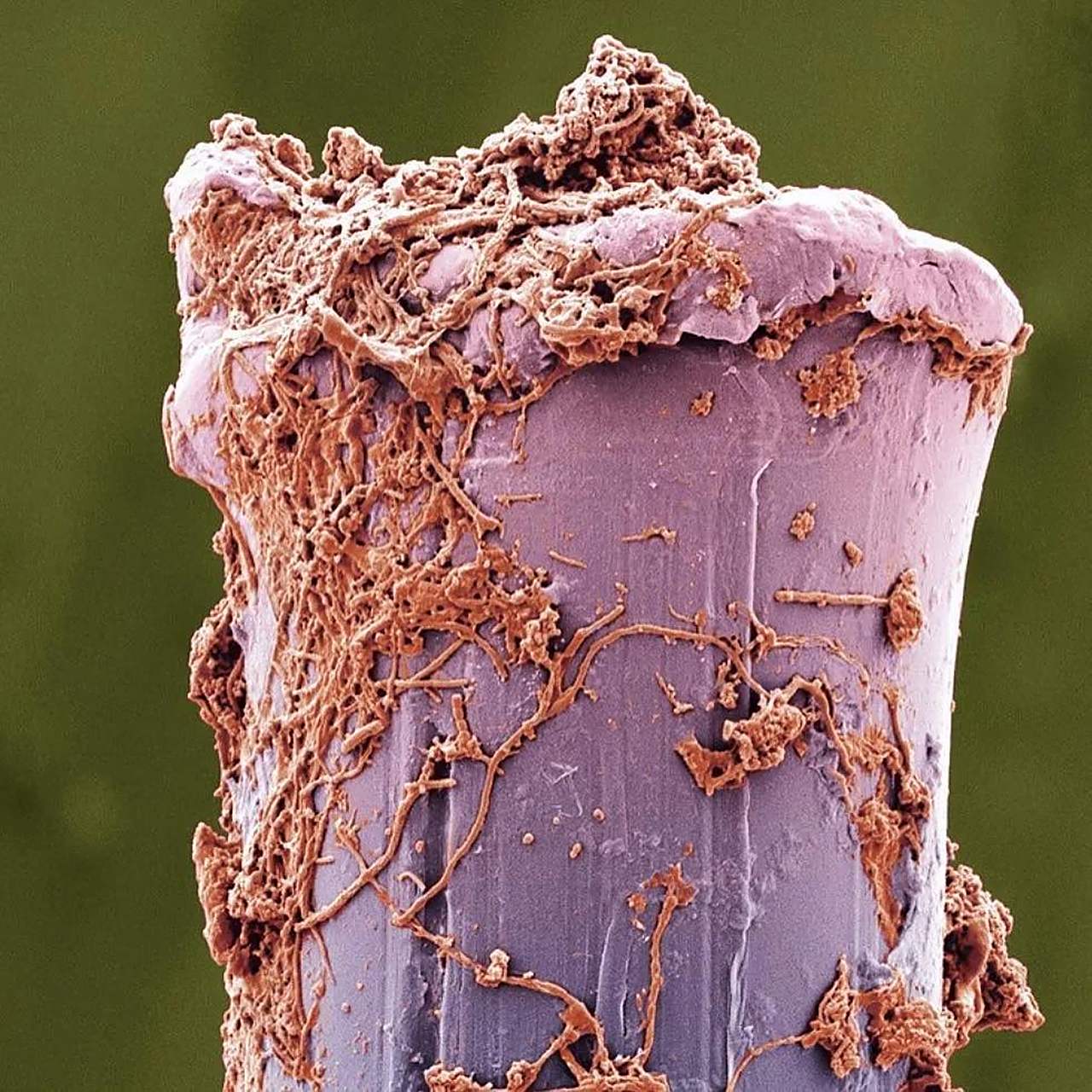 微观视图:带有红细胞和白细胞的肝毛细血管的电子显微镜图像,血管内的