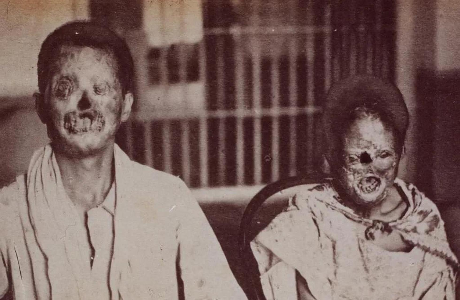 百家号星火计划# 【历史老照片】 清朝末年,麻风病患者