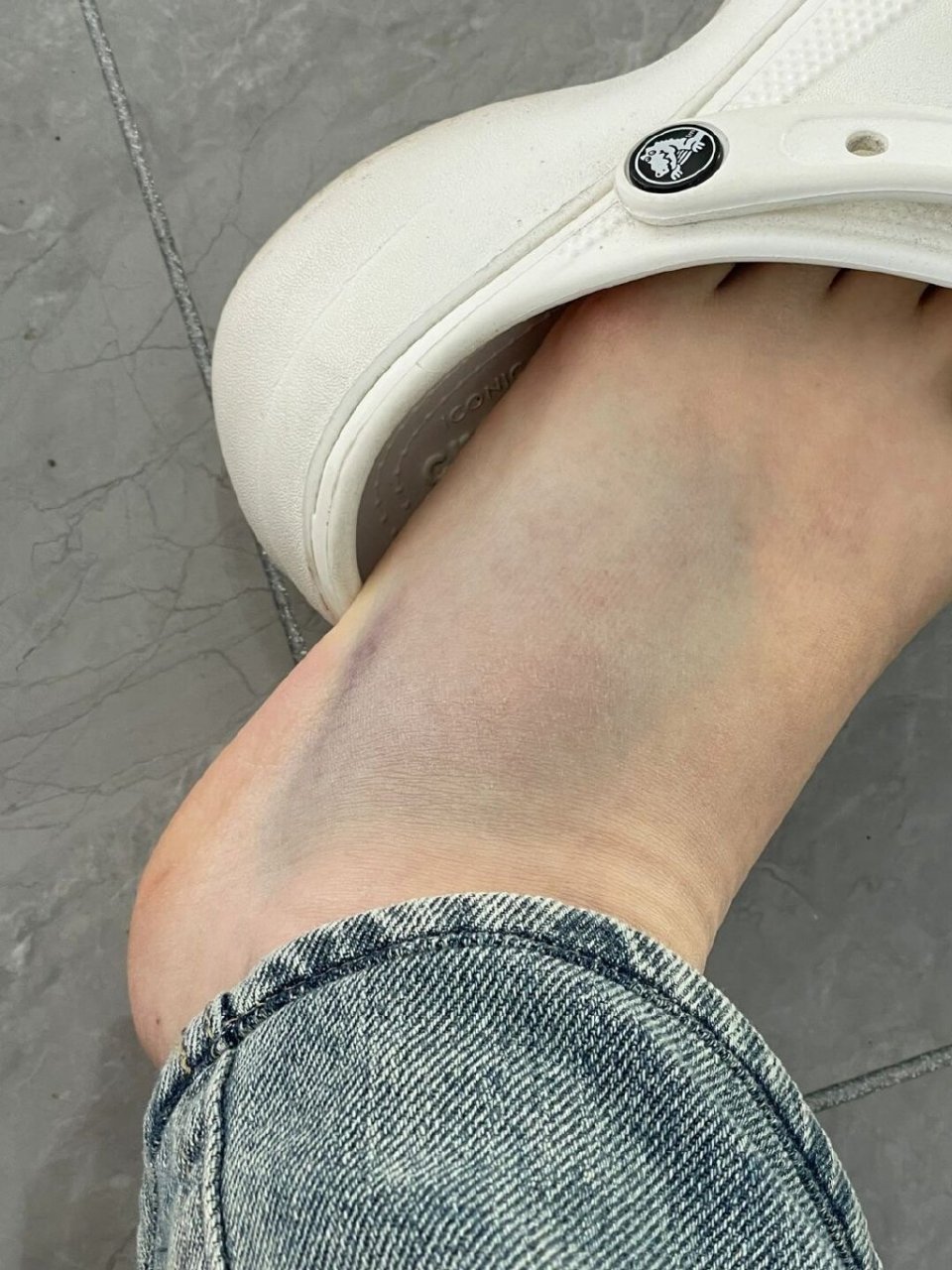 穿洞洞鞋千万要小心[并不简单]一不注意脚就崴了