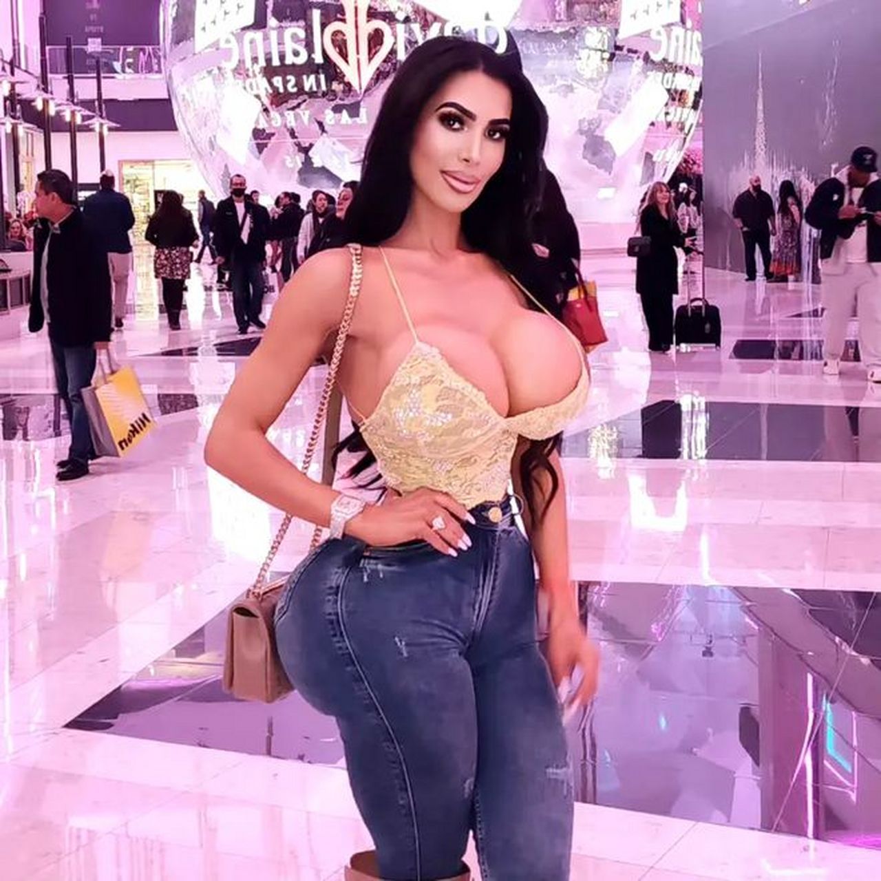 美网红追求卡戴珊身材整形后去世:死于心脏骤停,年仅34岁