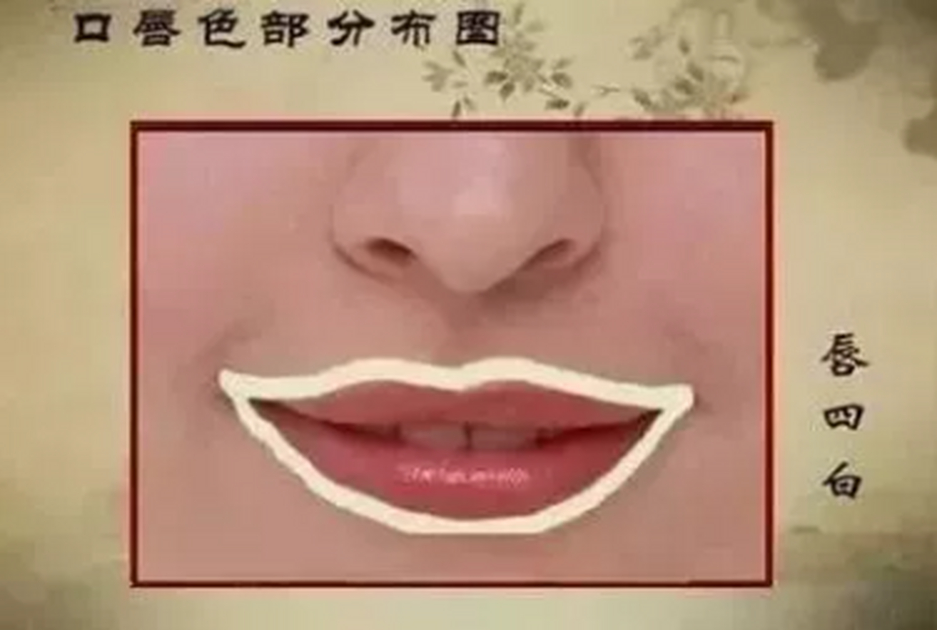 1,"唇四白"发黑——脾虚湿盛 2,嘴角生疮——脾虚湿气淤阻,或是胃火