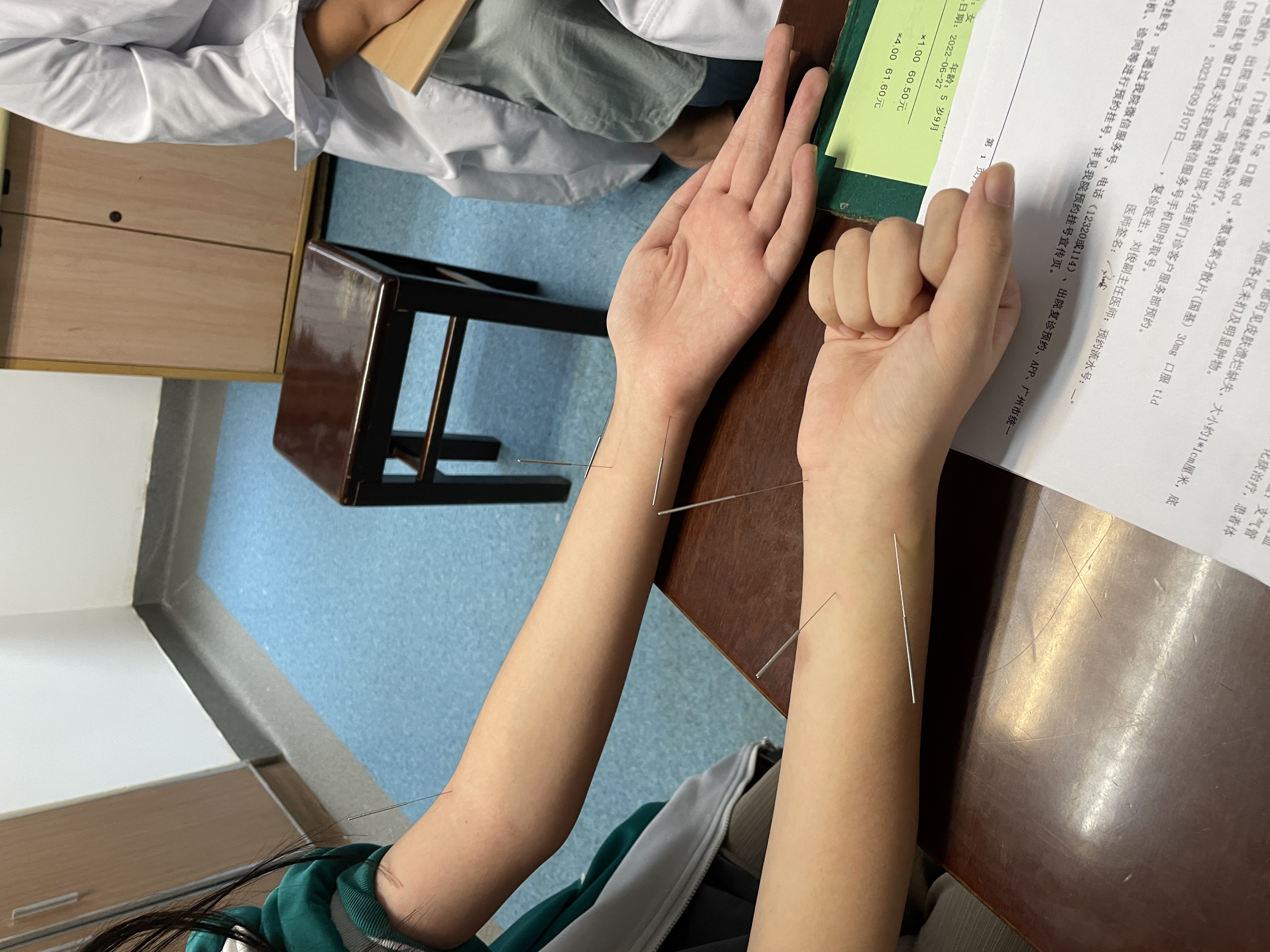 "扎一扎"就好 孩子的体质差这可能是孩子的脾胃方面的问题,通过针灸