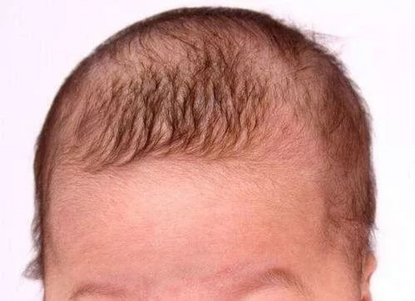 "  其实吧,宝宝头发看起来又稀又黄,是因为头上还顶着"胎毛".