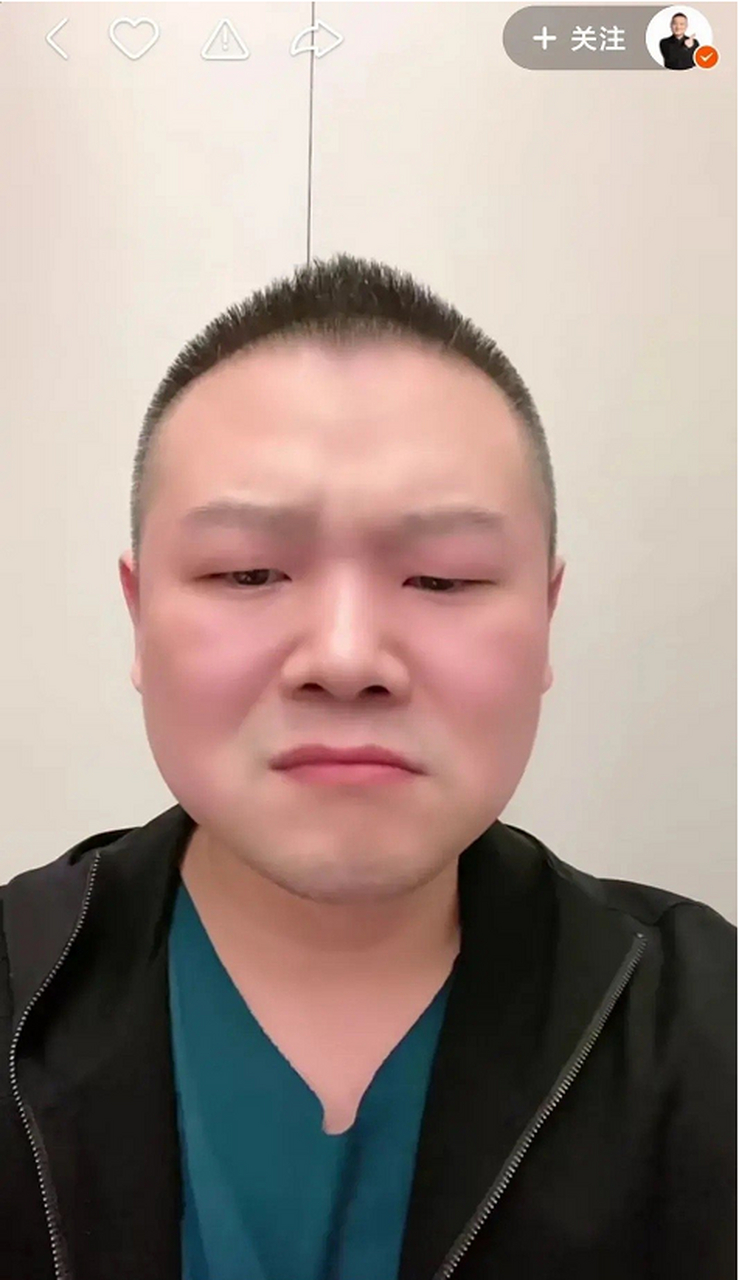 "小岳岳"岳云鹏自爆脱发!