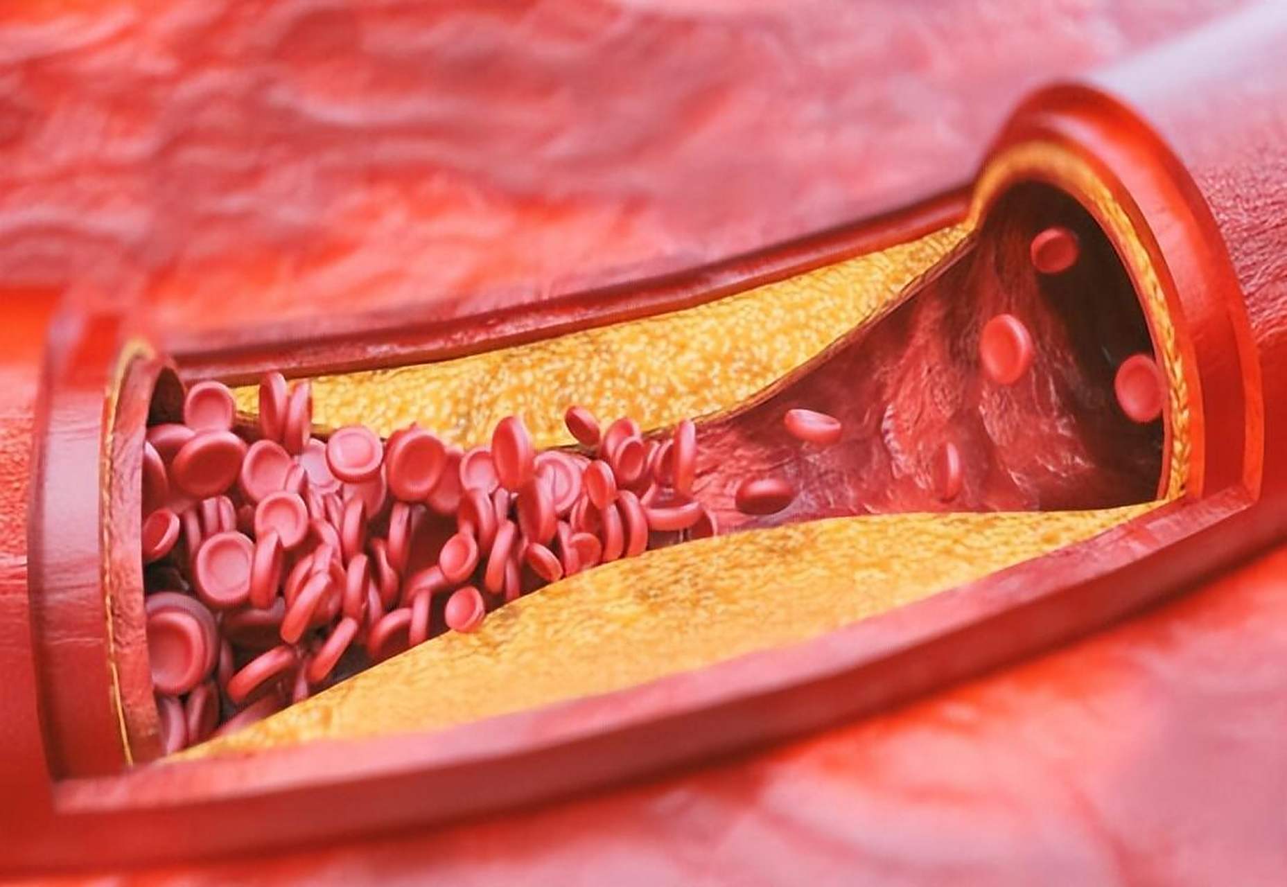 想要改善身上多处血管淤堵,其实很简单,只需要3味药 很多50多岁以后的