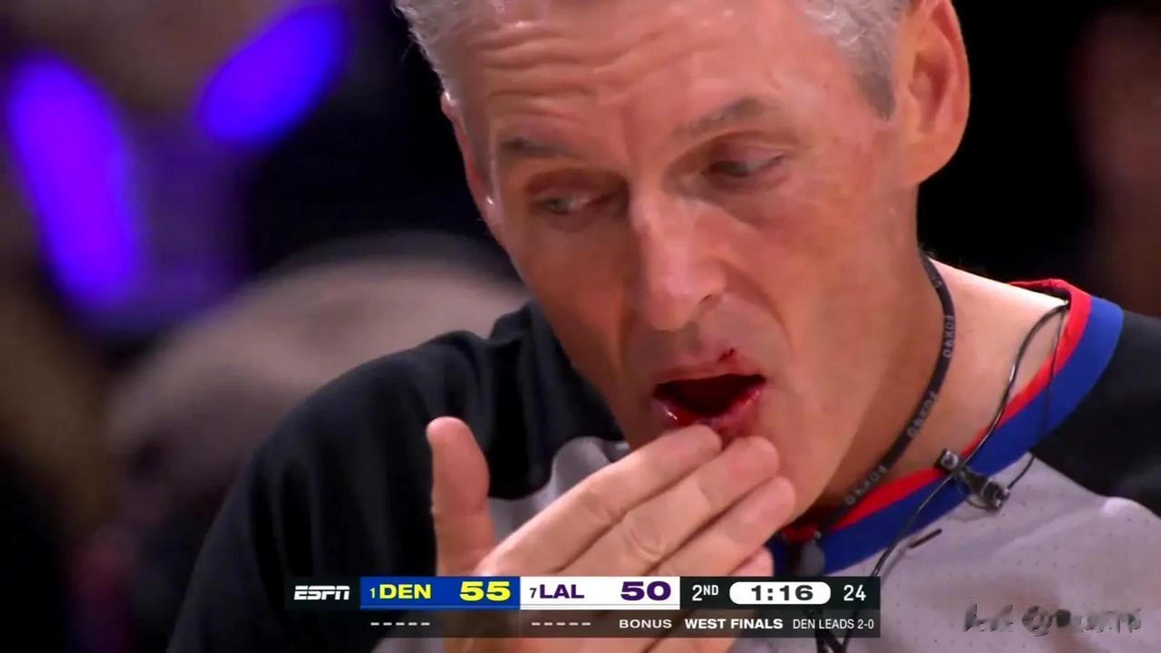 裁判福斯特谈自己被詹姆斯撞伤:"那是一次意外,勒布朗不是故意的,他