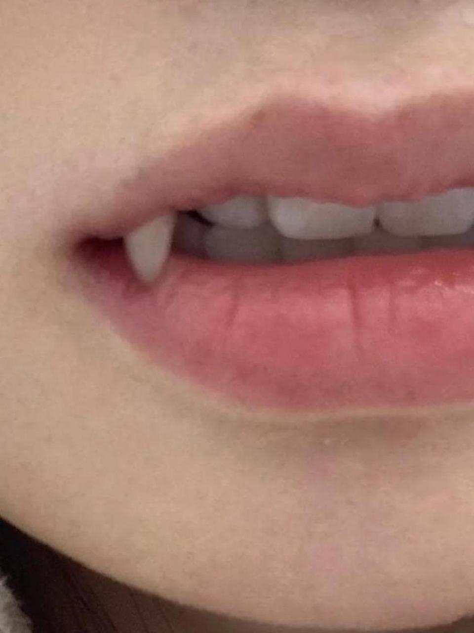 谁有这么长的小虎牙?