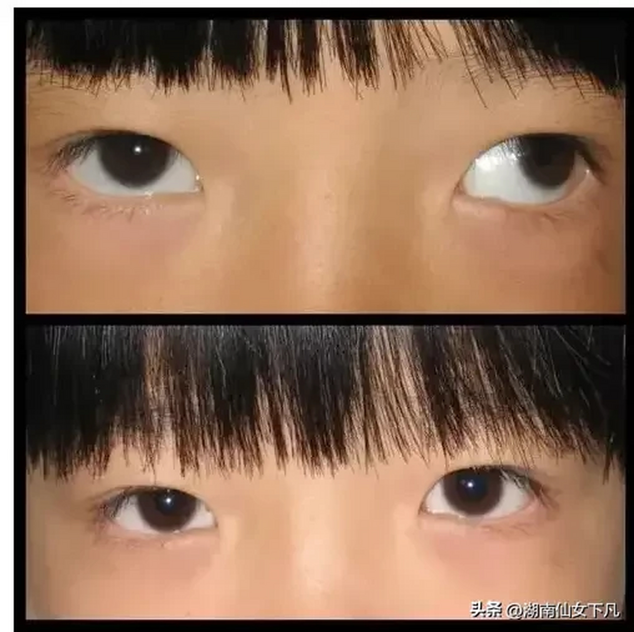 王胖姐夫哥的斜视眼代表着他心地坏吗?