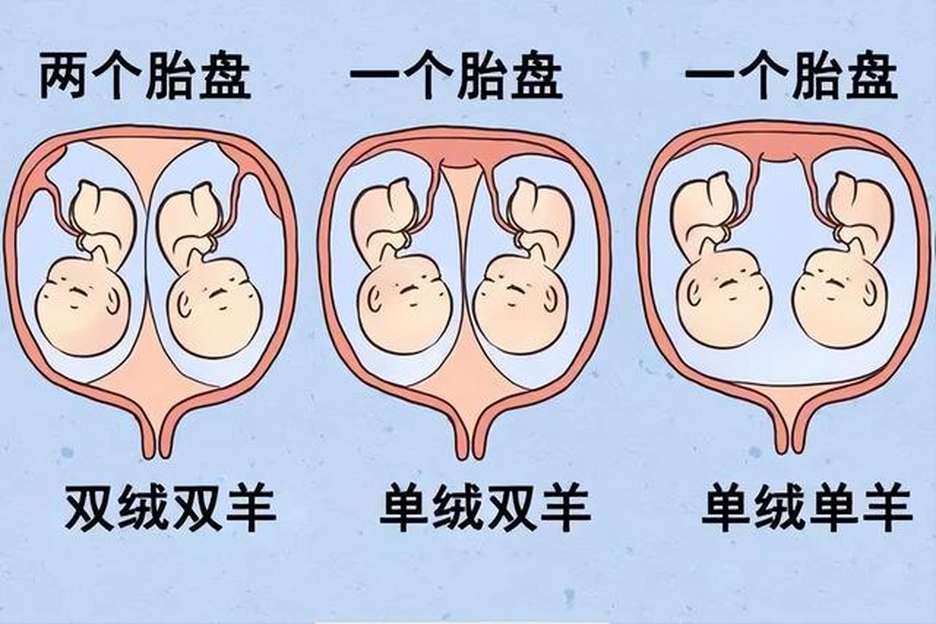 双绒双羊双胞胎图片图片