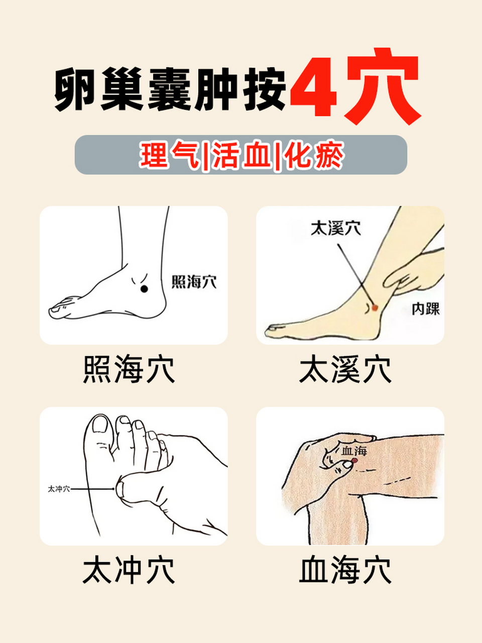 身上4个散囊穴  每天按一按  卵巢囊肿不敢牛  中医认为,卵巢囊肿的