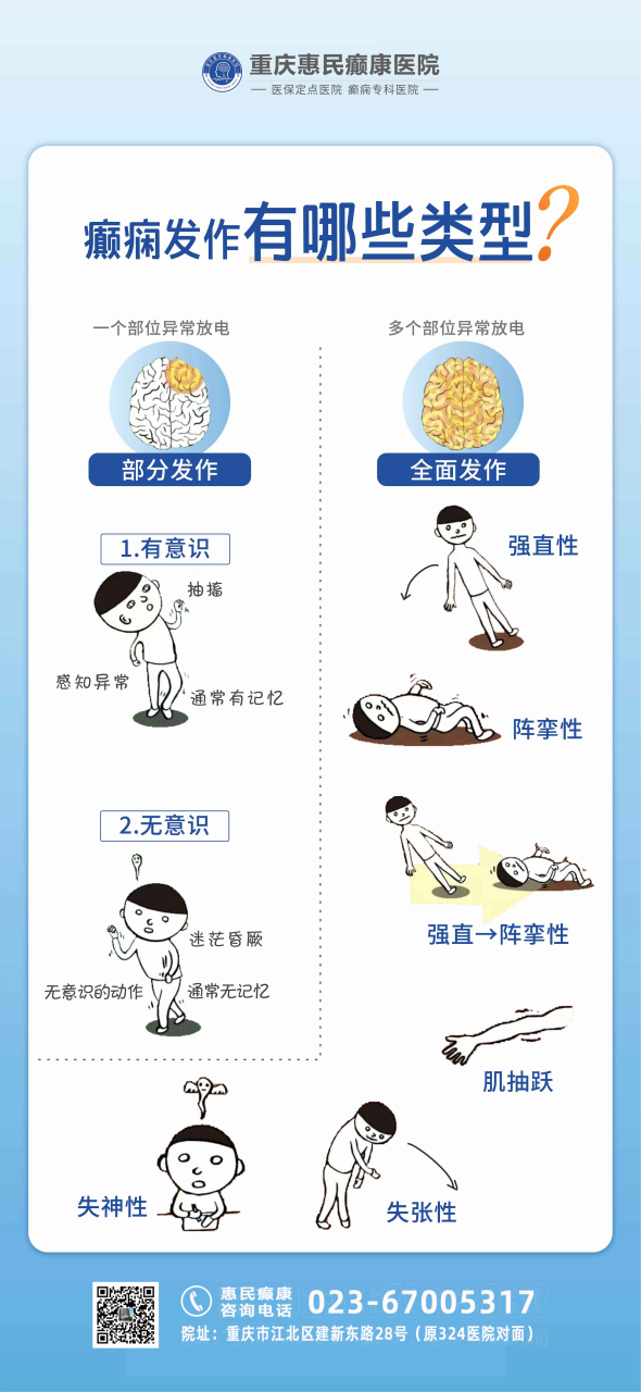 癫痫有哪些类型,发作时典型的症状是什么?