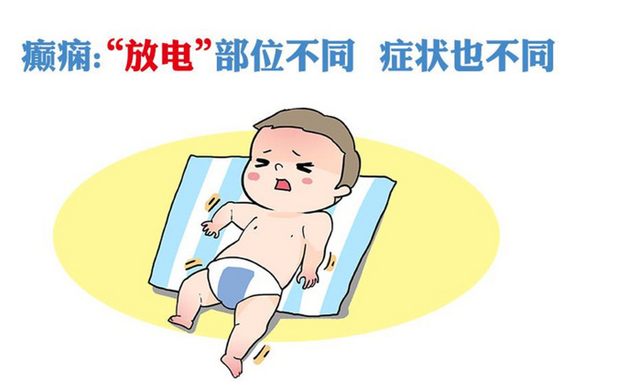 孩子有这些行为,可能是癫痫发作信号!  1.