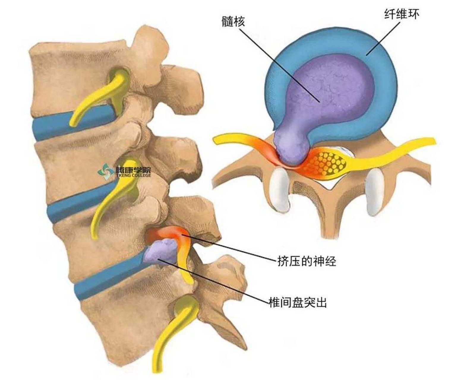 腰椎间盘位置结构图图片