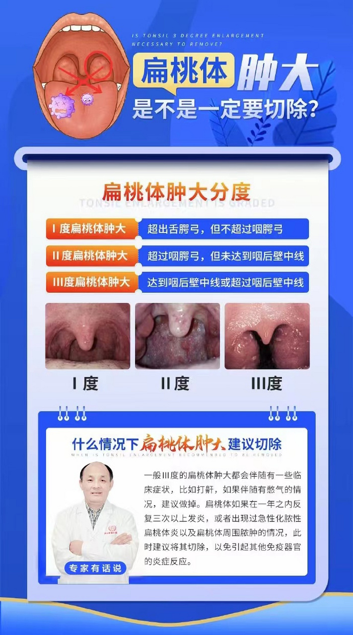 扁桃体肿大# #中大耳鼻喉医院怎么样#  #扁桃体肿大不一定要切