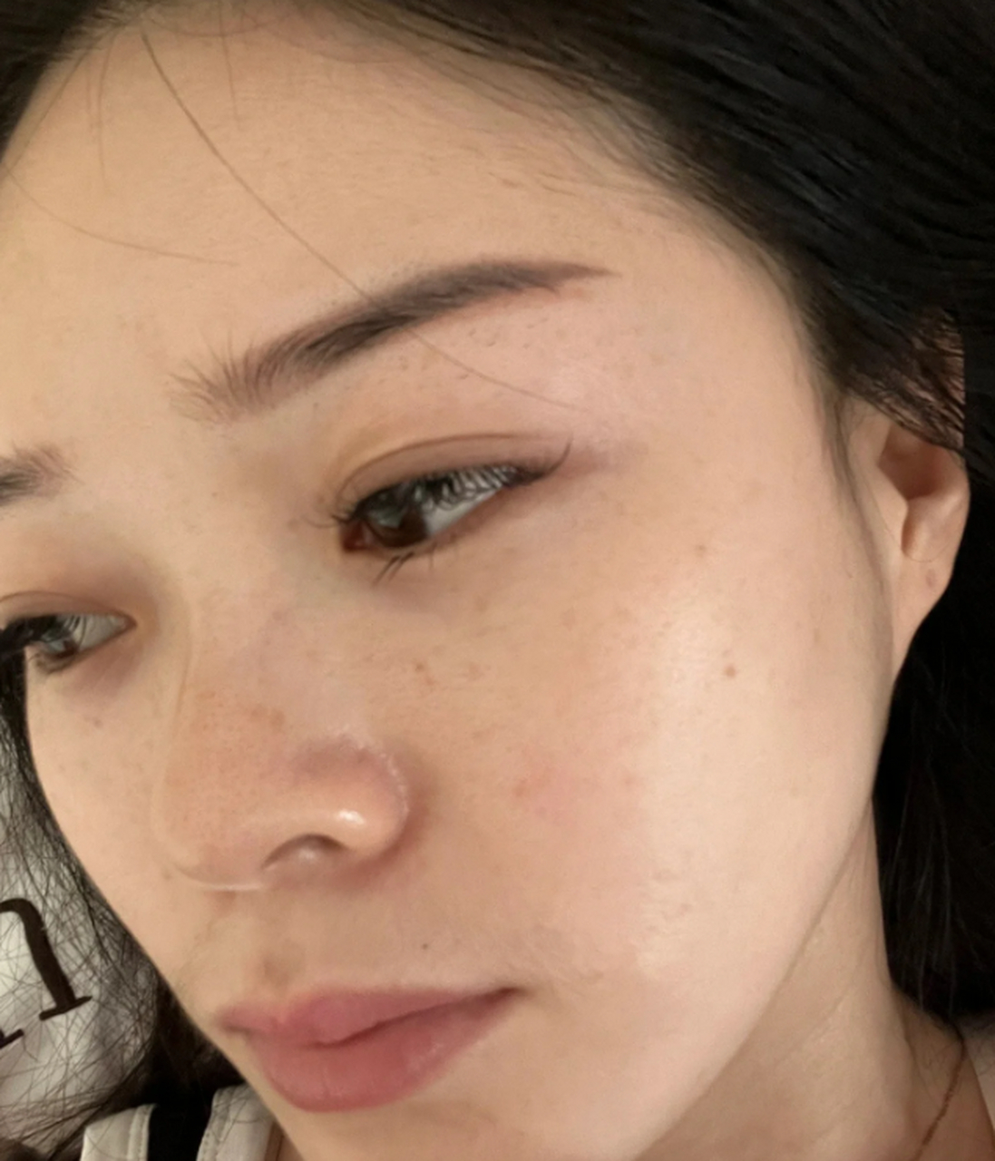 拥有明亮均匀的肤色是每个人的美丽追求,然而,很多人都受到肤色不匀