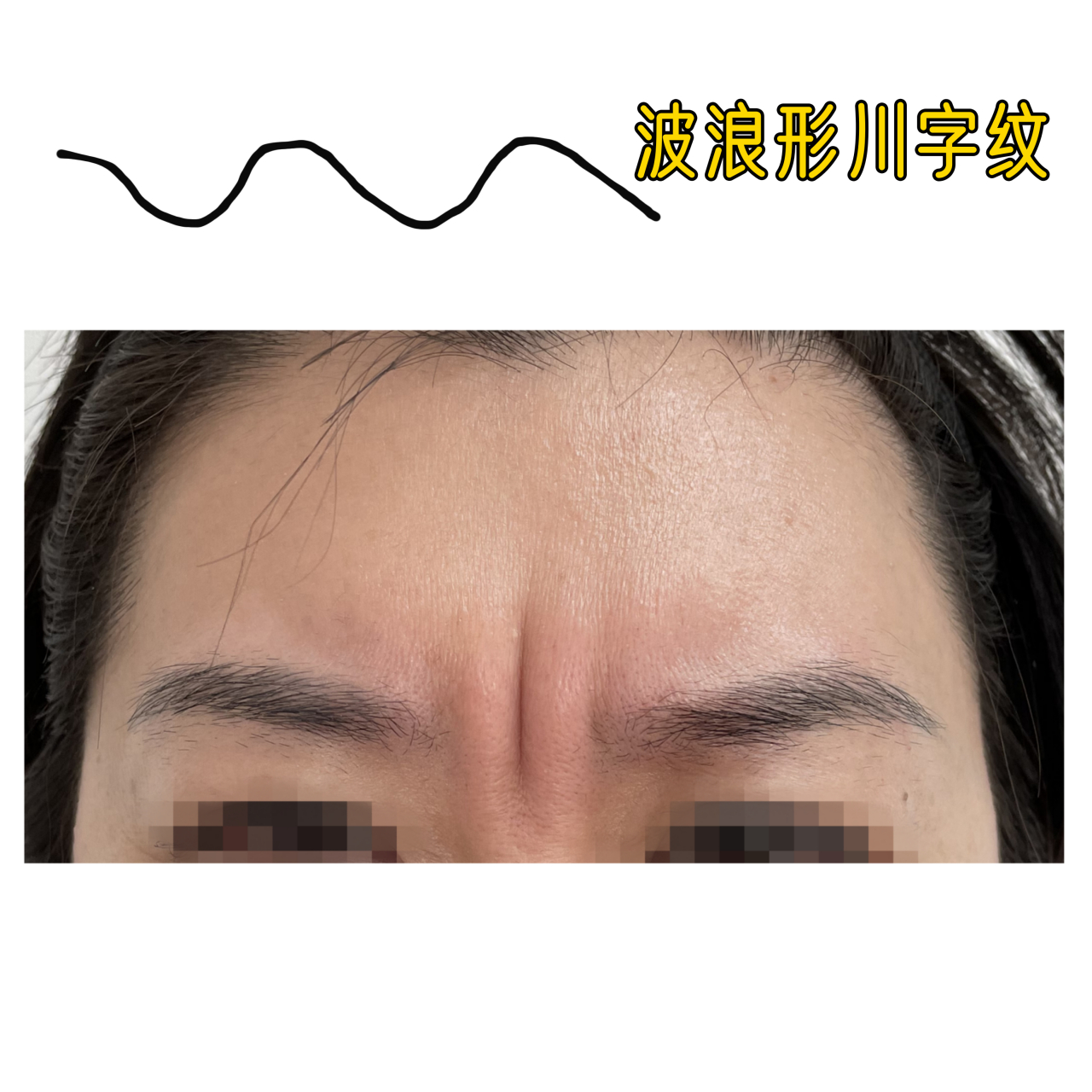 古人云:"印堂悬针纹粗显,刑夫斩子灾必见".