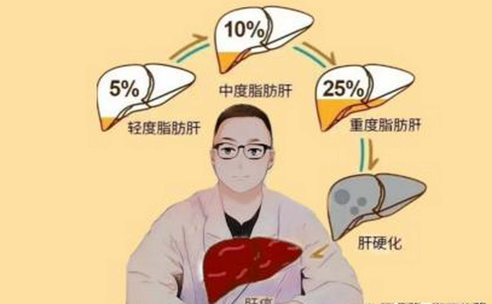脂肪肝到肝硬化只需要3步,脂肪肝一脂肪性肝炎一肝纤维化一肝硬化,肝