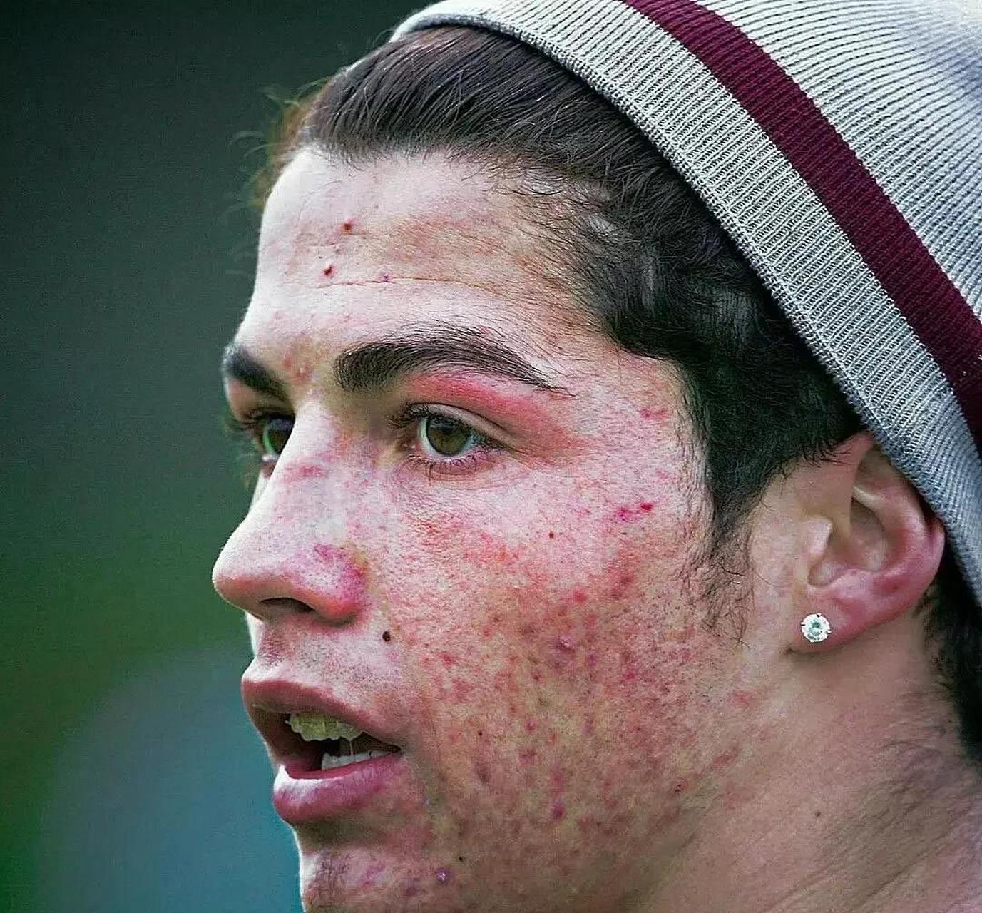 今日图评丨附图是年轻的c罗!