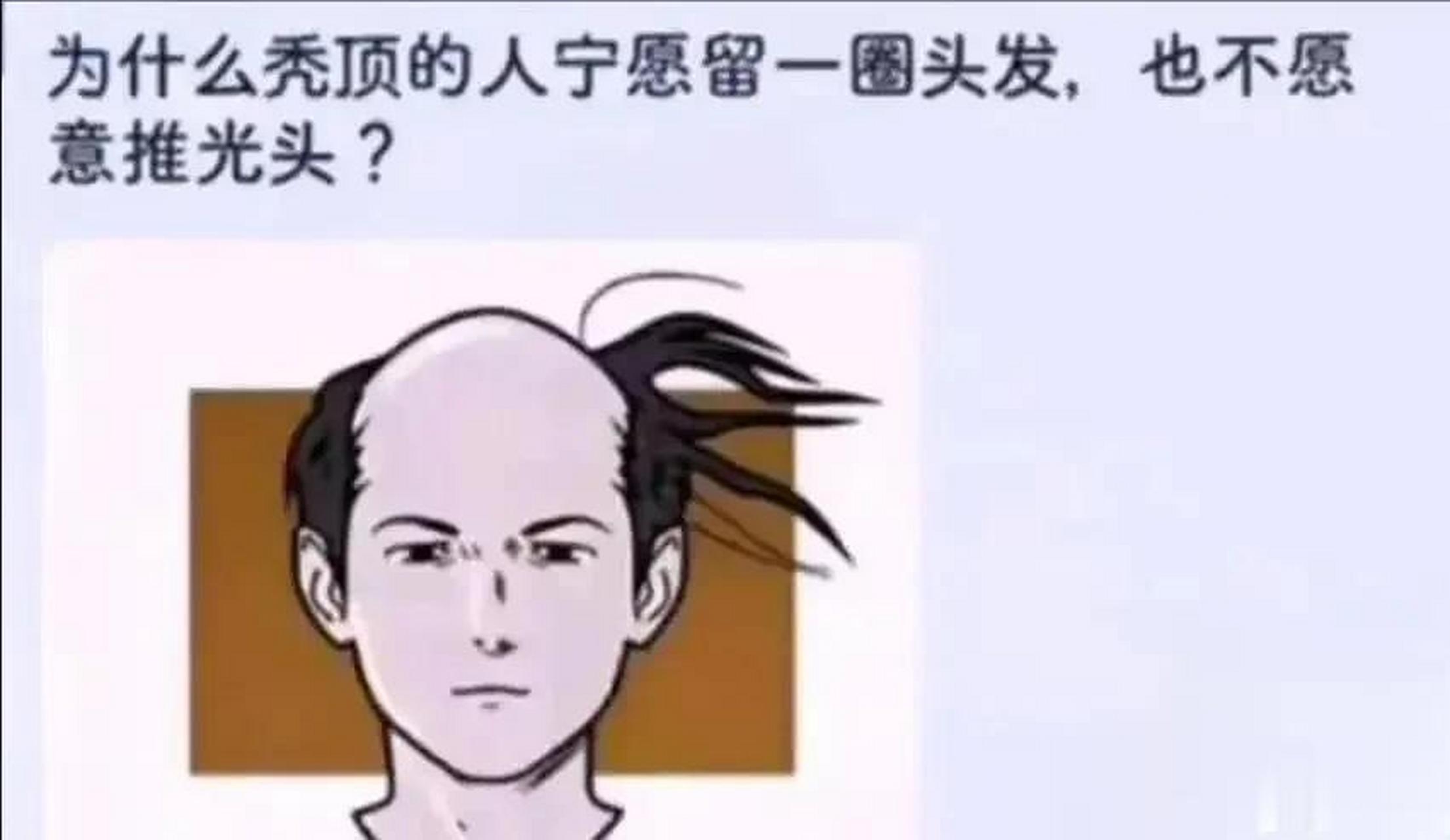 很好奇,为什么秃顶的人宁愿留一圈头发,也不剃光头?这是最后的倔强吗?