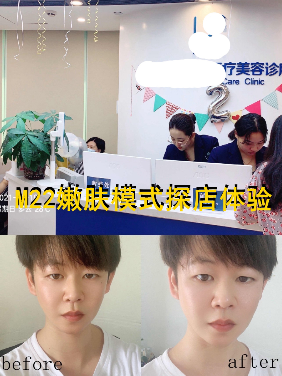 光子嫩肤多久做一次:m22嫩肤模式探店体验! . 当当当.