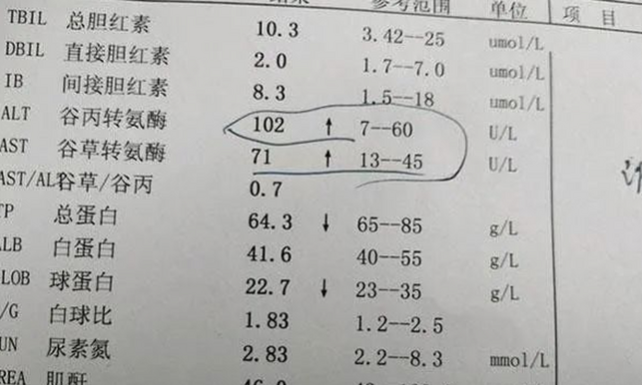 肝功能化验单图片图片