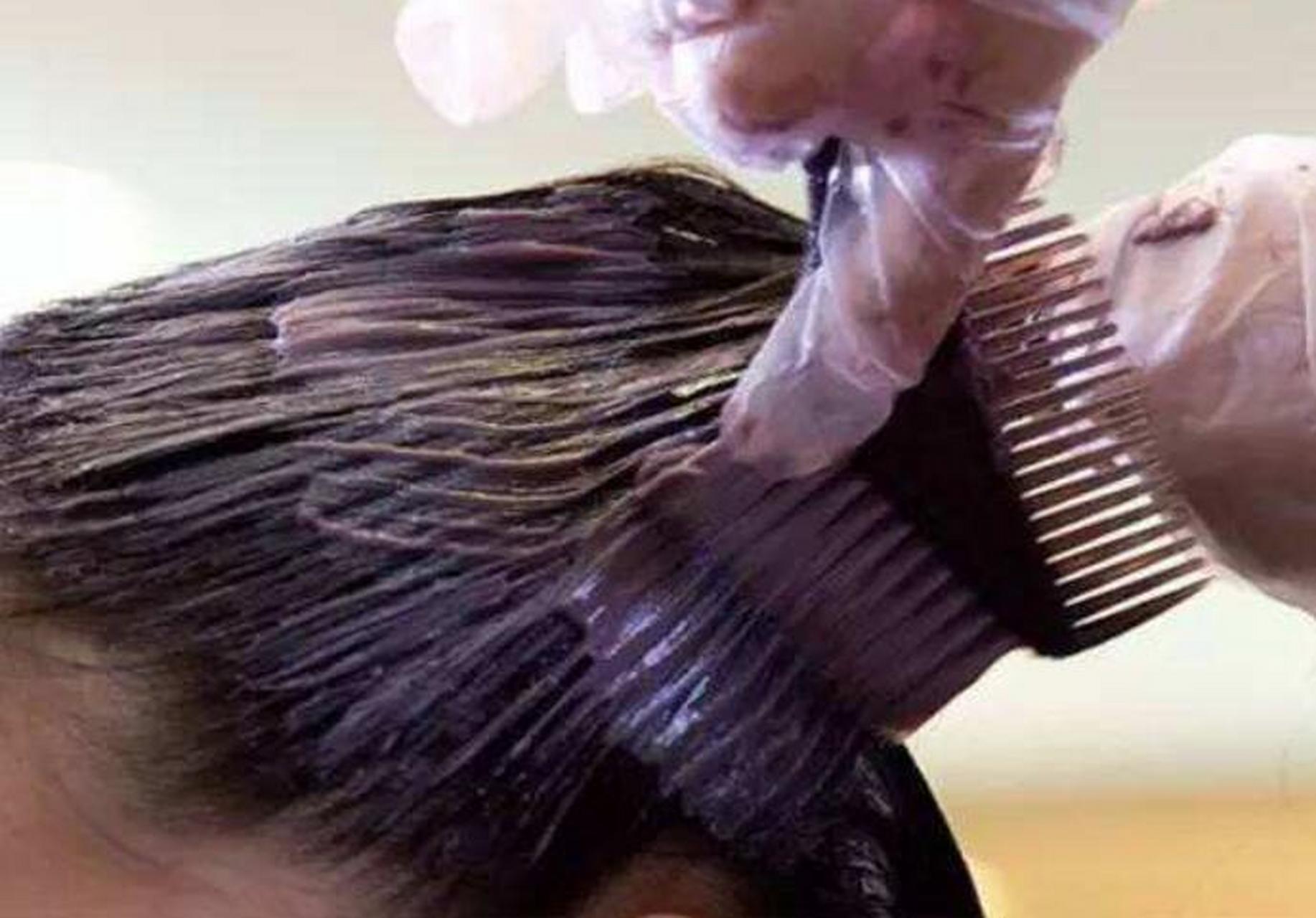 到加强染发时固色效果,但是她具有很强的致敏作用,常常会引起皮肤过敏