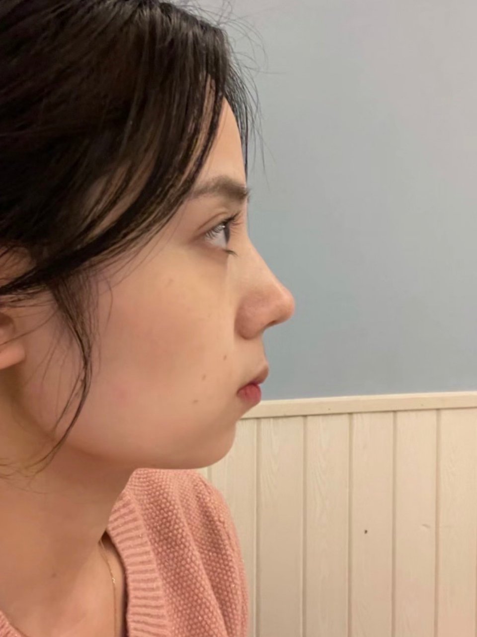 驼峰鼻好看大概仅限微驼.