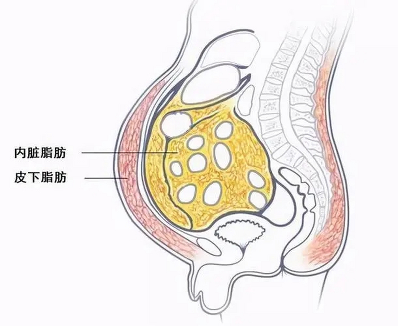 肥胖肚子内部脂肪图片图片