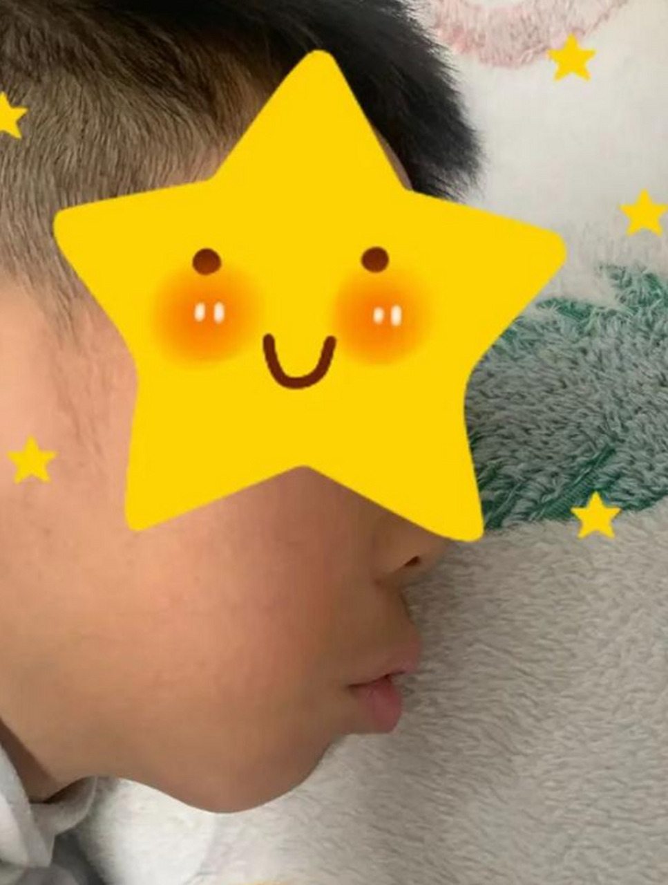 腺样体肥大,鼻炎,扁桃体炎是导致口呼吸的常见的原因,那怎么判断孩子