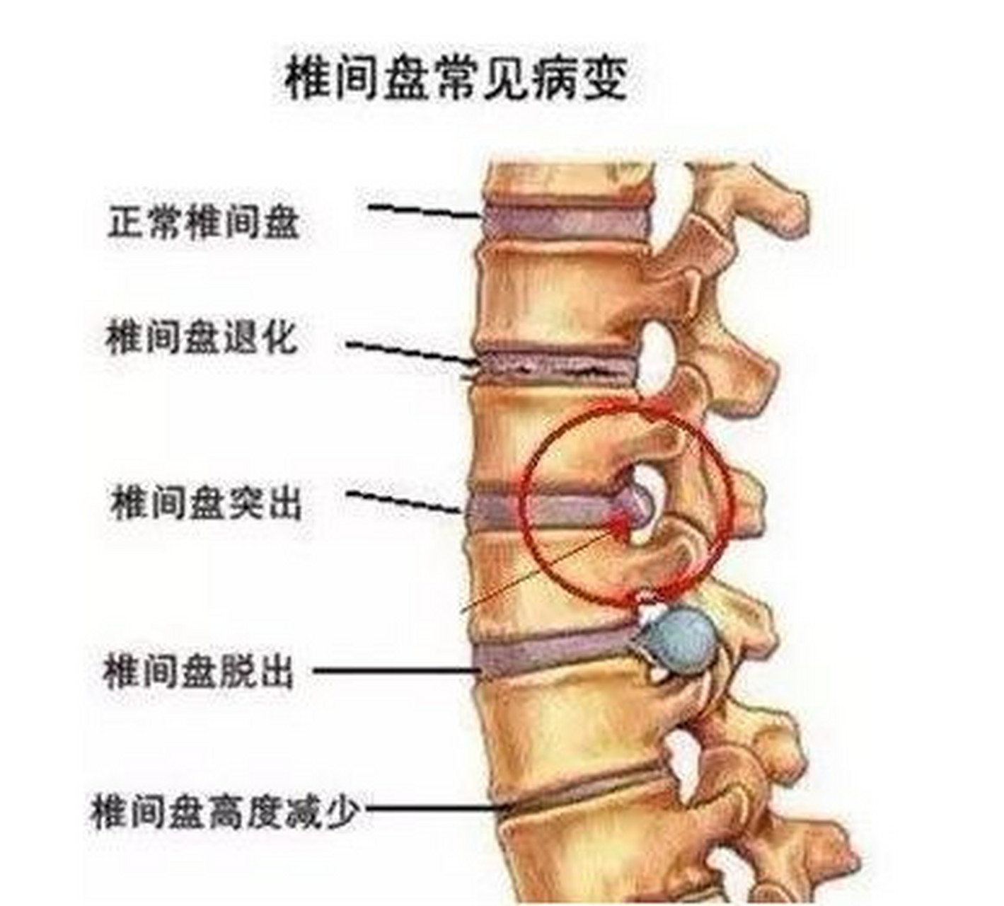 腰椎位置图片大全图片