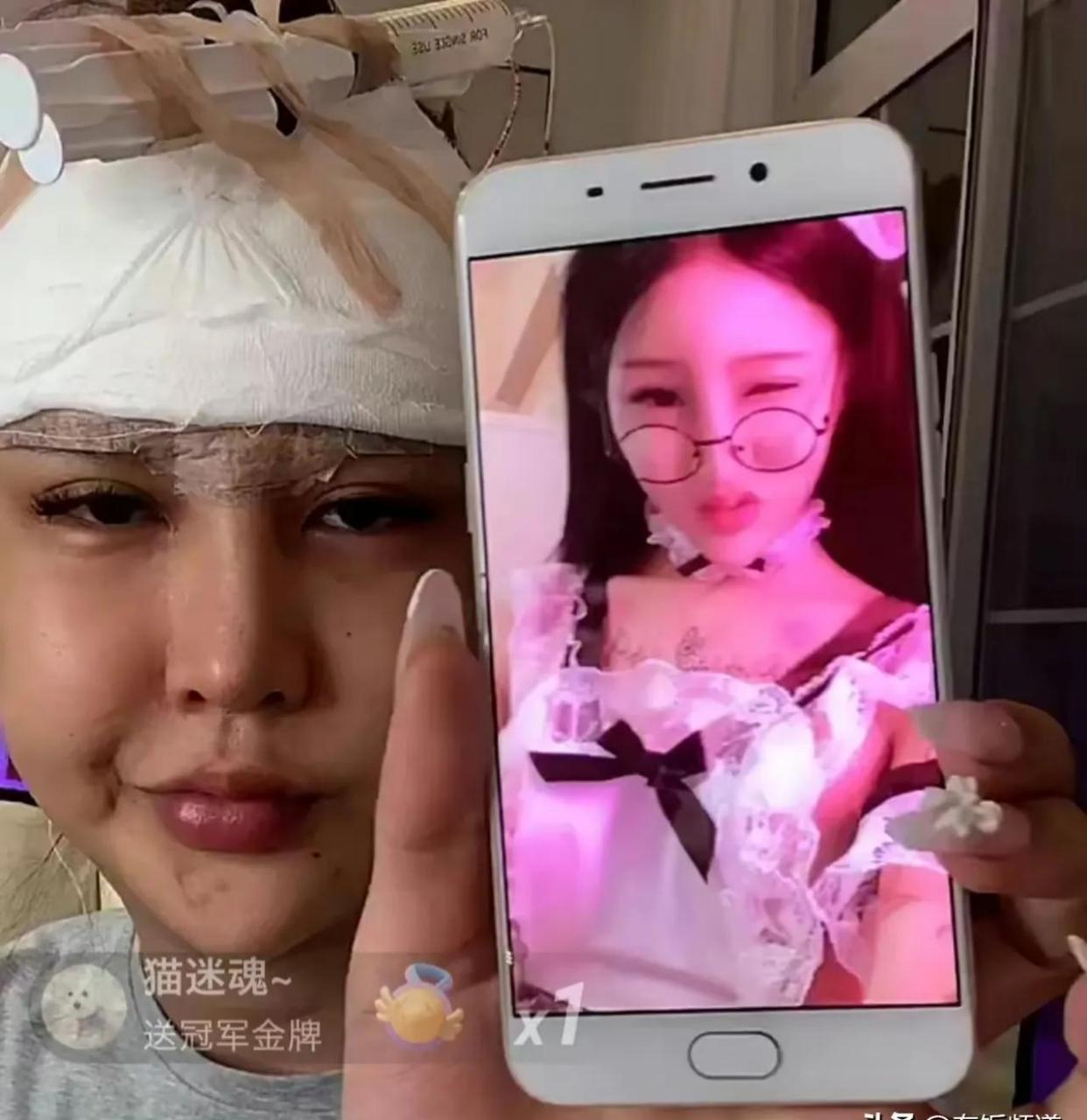 百家号星火计划# 桃花宝宝没整容之前,确实漂亮!