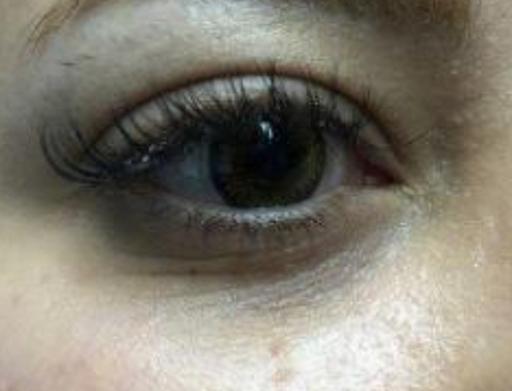 下边几张图分别是泪沟进化的不同程度,来看看你现在的泪沟是哪一种吧!